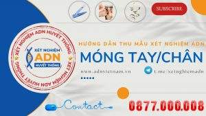 Anh Bia Thu Mau Mong Tay Chan Youtube Chuan