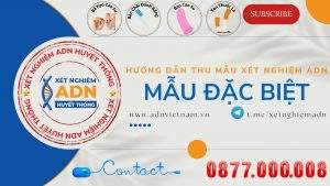 Anh Bia Thu Mau Dac Biet Youtube Chuan