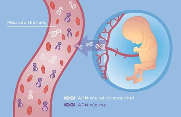 ADN tự do của thai nhi có trong máu của mẹ