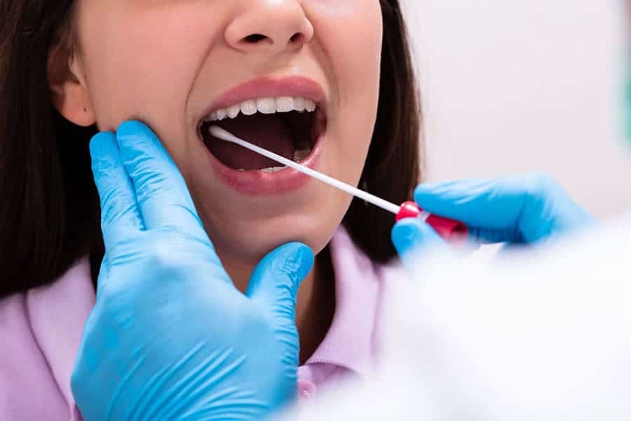 Niêm mạc miệng là các tế bào biểu mô trong khoang miệng