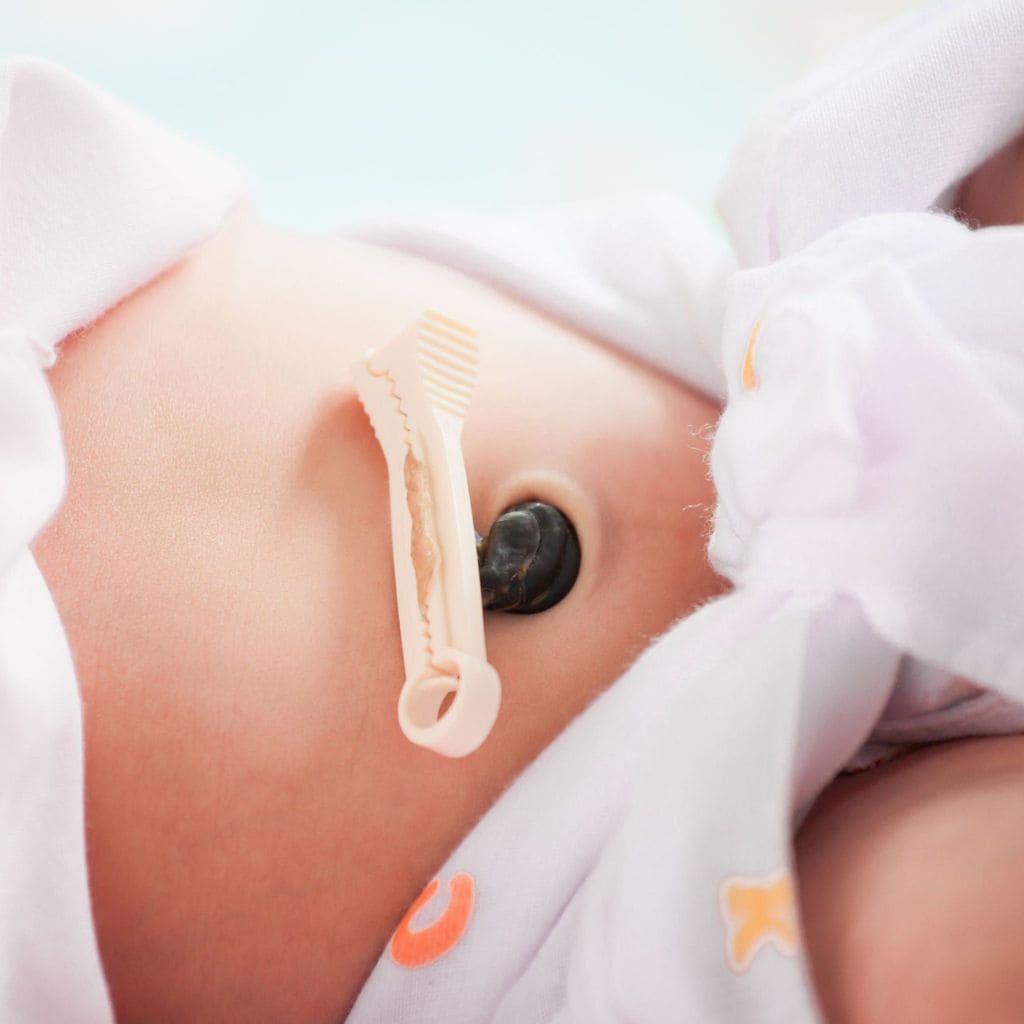 Xét nghiệm ADN bằng cuống rốn là phương pháp thường dùng đối với trẻ sơ sinh